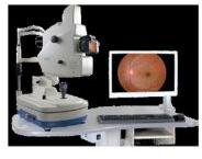 Fundus Camera