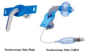 Tracheostomy Tube