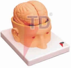 HUMAN HEAD WITH BRAIN MODEL