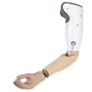 Above Elbow Myo Hand Prosthesis