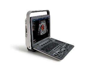 Sonoscape S8 Expert Doppler Ultrasound