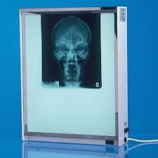 X-Ray view screen