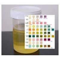 urine rm test