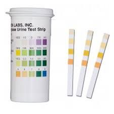 Urine Test Strip