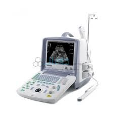 Digital Ultrasound Diagnostic Device