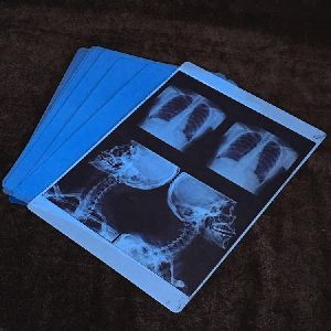 inkjet x-ray film