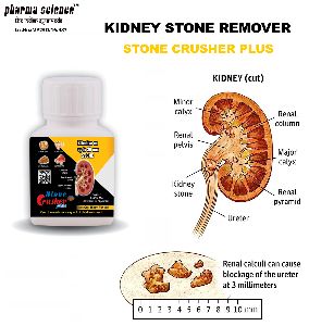 Kidney Stone Ayurvedic Medicine