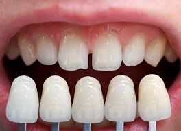 cosmetic dentistry