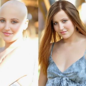 Chemo Patients Women Wigs