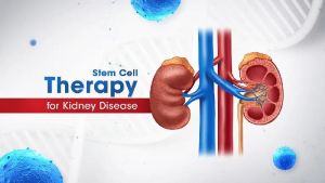 Stem Cell Therapy for Kidney Disease