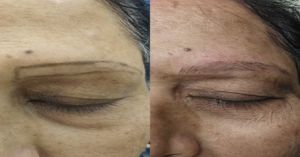 Microblading Treatment