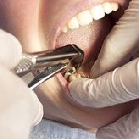 oral surgery services