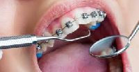 Orthodontics Treatment Services