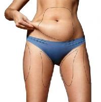4D Liposuction Surgery
