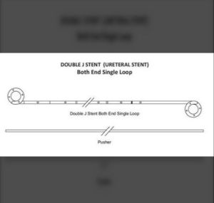 Double J Stent