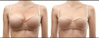 Breast Reduction