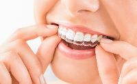 Invisalign Dental Service