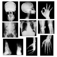 digital x-ray services