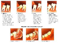 Oral Surgery Treatment Services
