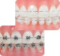 orthodontic treatment services