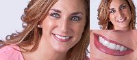 Cosmetic Dentistry Services