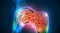 Osteoporosis Stem Cell Treatment Services