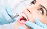 Root Canal Treatment