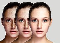skin pigmentation treatment services