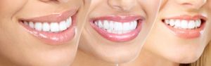 Smile Designing & Makeover Treatment Services