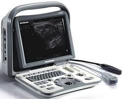 sono scape a6v e1v veterinary ultrasound scanner