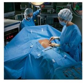 Laparoscopy Drape