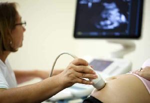 doppler ultrasound scanner