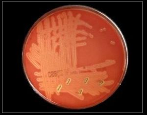 Blood Agar Plate Gentamicin