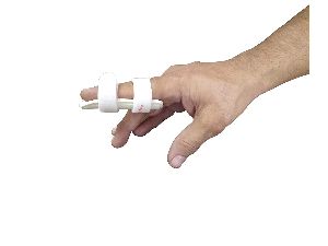 Static Finger Splint