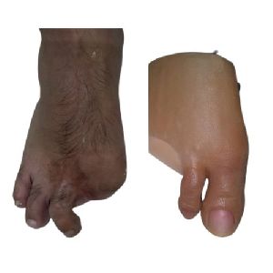 Silicone Artificial Foot Finger