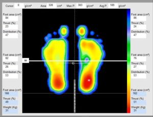 Foot Scanner