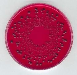 Xylose Lysine Agar