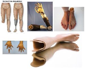 Artificial Limbs