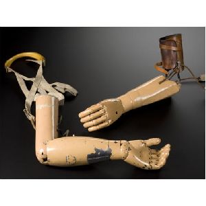 upper limb Prosthesis