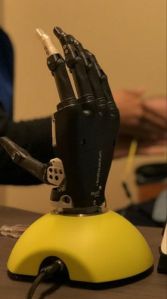 Bionic Upper Limb Prostheses