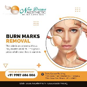 Scars & burn mark removal in newderma aesthetic clinic mira bhyander