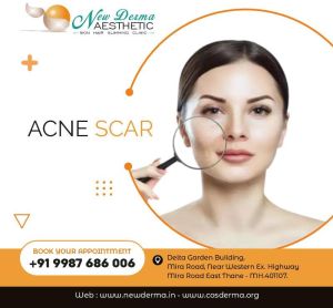 Acne treatment in newderma aesthetic clinic mira bhyander