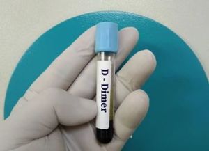 D Dimer Test