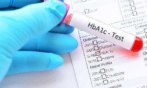 HbA1C Test