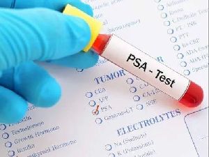 PSA Test