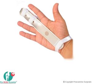 Finger Extension Splint