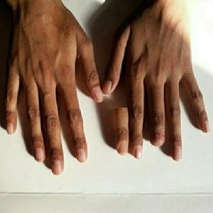 SILICONE FINGER PROSTHESIS