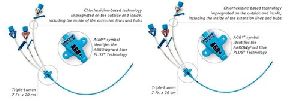 Central Venous Catheter