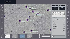 Sperm Pro Computer Aided Sperm Analysis Software