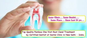 Painless Root Canal Treatment in Delhi